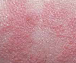 AtopiCream HC™ with Hydrocortisone - vetrimaxproducts